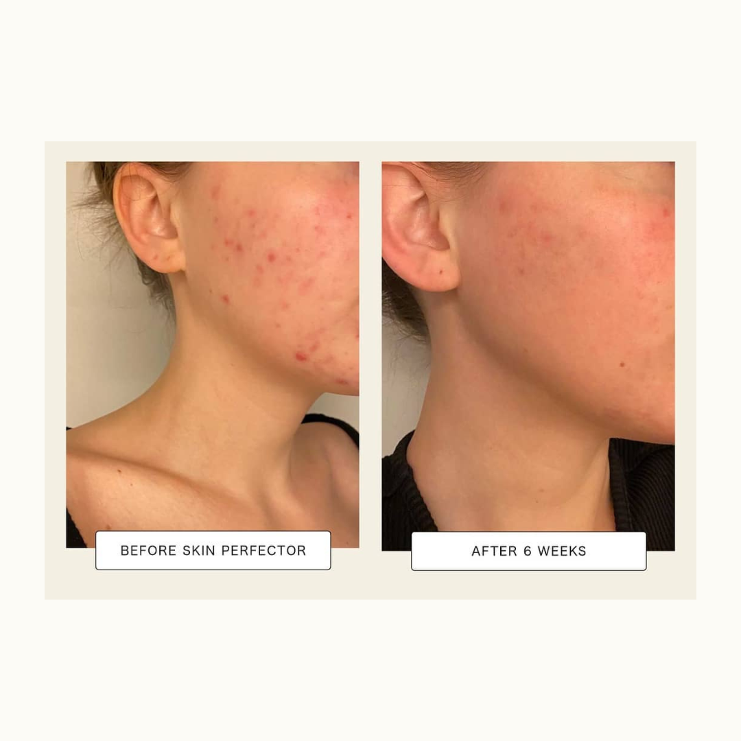 Sérum Anti-Imperfections Visage 2% BHA